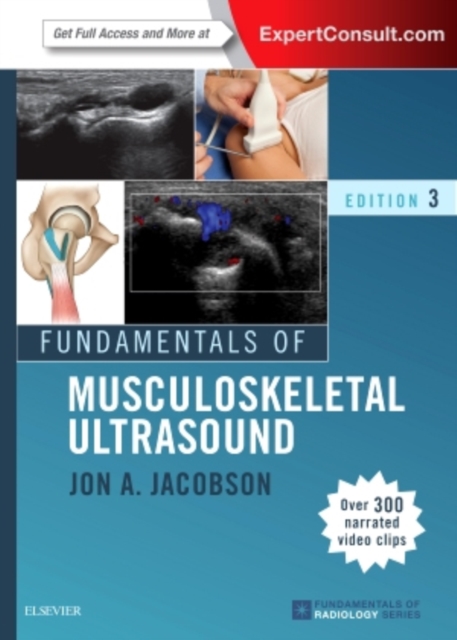 Fundamentals of Musculoskeletal Ultrasound, Paperback / softback Book