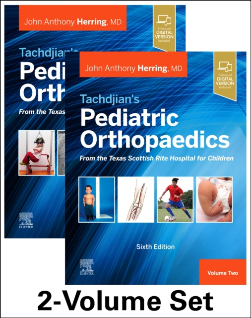 Tachdjian's Pediatric Orthopaedics: From the Texas Scottish Rite Hospital for Children, 6th edition : 2-Volume Set, Multiple-component retail product Book