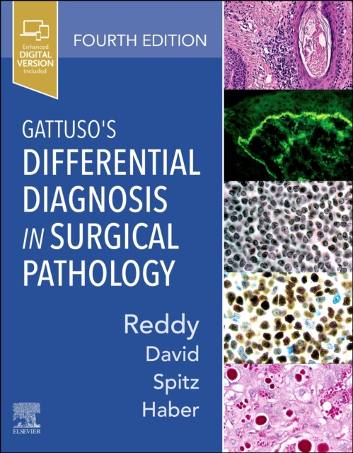 Gattuso's Differential Diagnosis in Surgical Pathology, Hardback Book