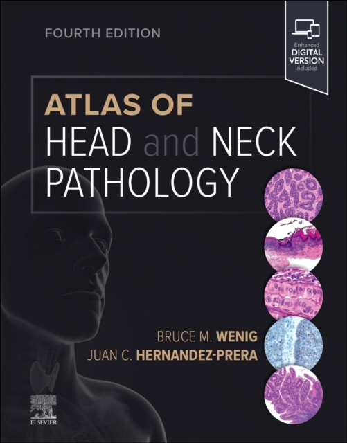 Atlas of Head and Neck Pathology, Hardback Book