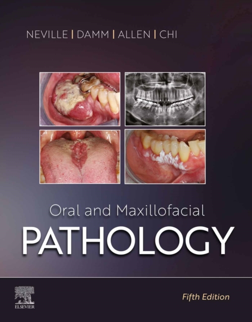 Oral and Maxillofacial Pathology - E-Book, EPUB eBook