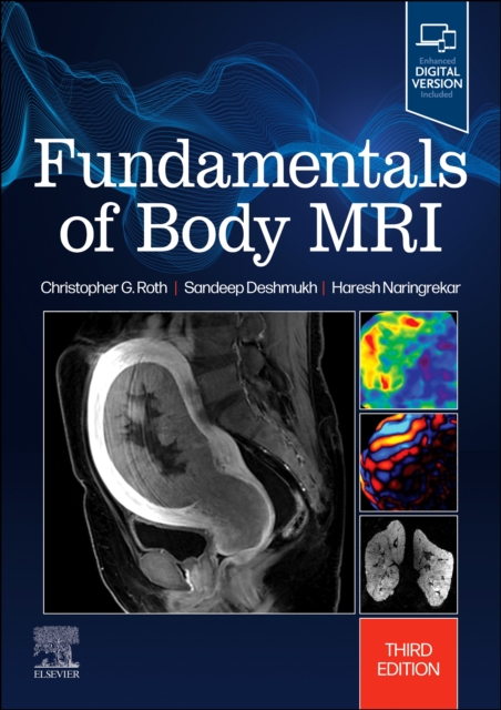 Fundamentals of Body MRI, Paperback / softback Book