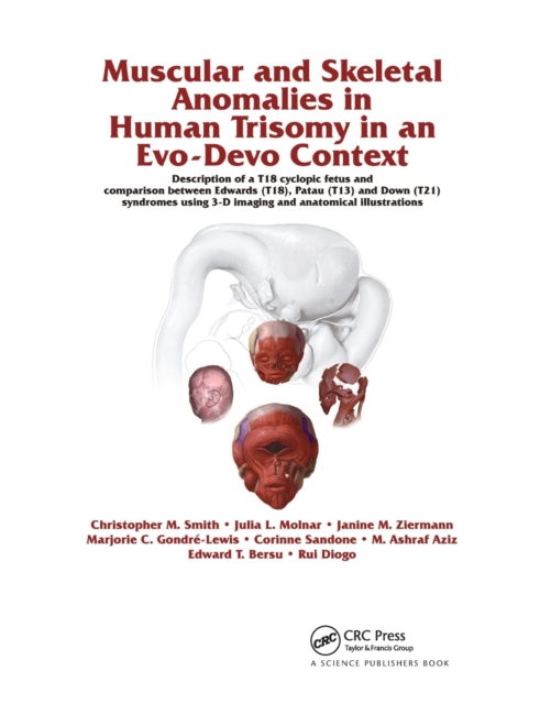 Muscular and Skeletal Anomalies in Human Trisomy in an Evo-Devo Context : Description of a T18 Cyclopic Fetus and Comparison Between Edwards (T18), Patau (T13) and Down (T21) Syndromes Using 3-D Imagi, Paperback / softback Book