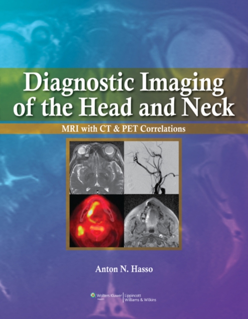 Diagnostic Imaging of the Head and Neck : MRI with CT & PET Correlations, Hardback Book