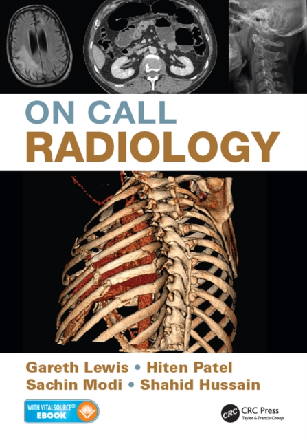 On Call Radiology, EPUB eBook