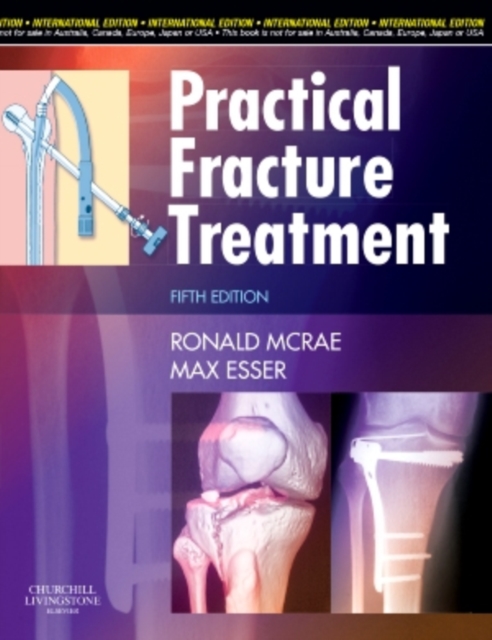 Practical Fracture Treatment, Paperback Book