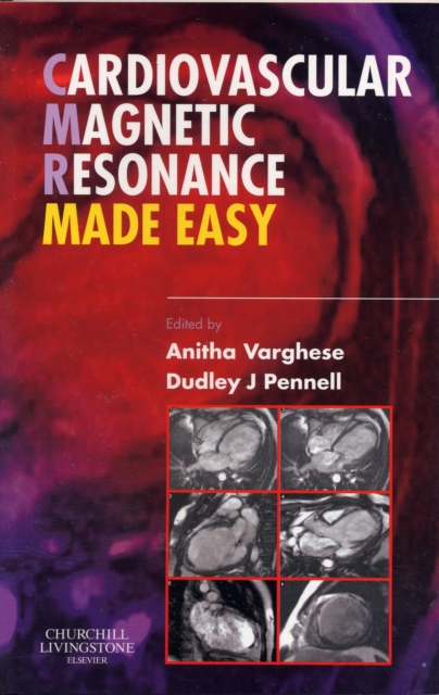 Cardiovascular Magnetic Resonance Made Easy, Paperback / softback Book