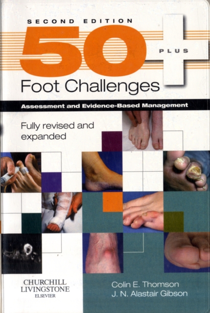 50+ Foot Challenges : Assessment and Evidence-Based Management, Paperback / softback Book