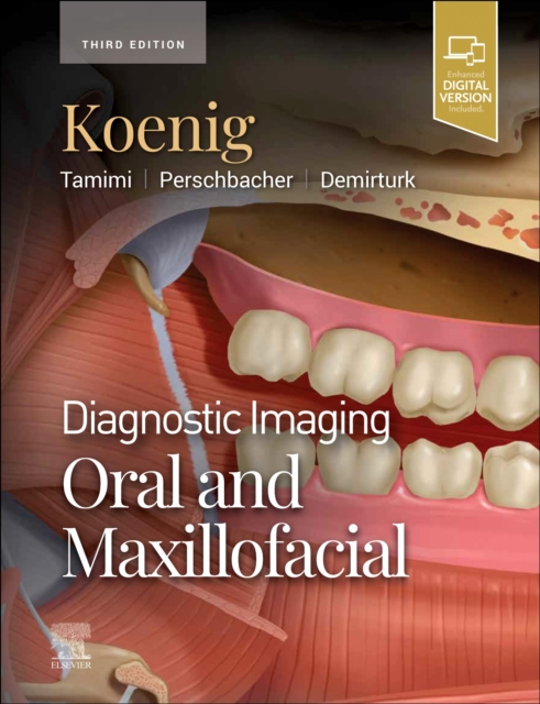 Diagnostic Imaging: Oral and Maxillofacial, Hardback Book