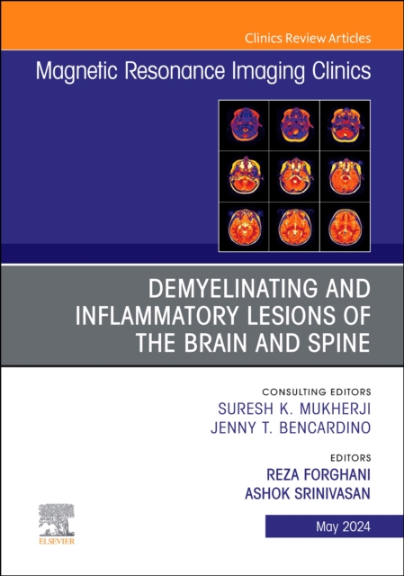 Demyelinating and Inflammatory Lesions of the Brain and Spine, An Issue of Magnetic Resonance Imaging Clinics of North America : Volume 32-2, Hardback Book