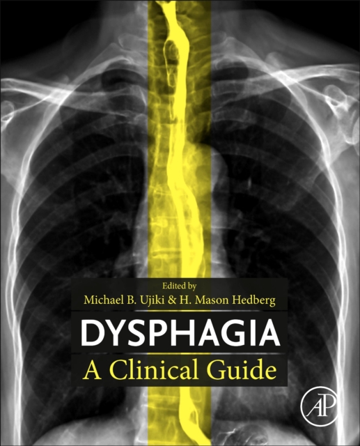 Dysphagia : A Clinical Guide, Paperback / softback Book