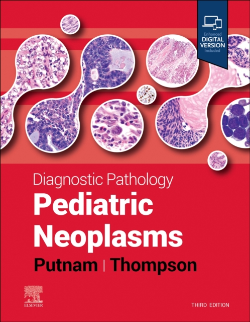 Diagnostic Pathology: Pediatric Neoplasms, Hardback Book