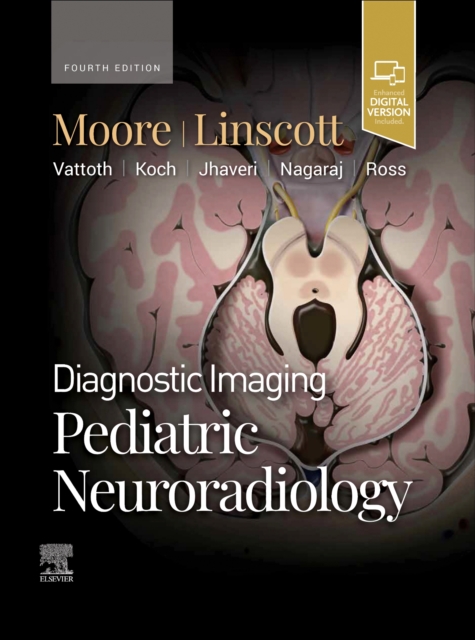 Diagnostic Imaging: Pediatric Neuroradiology, Hardback Book
