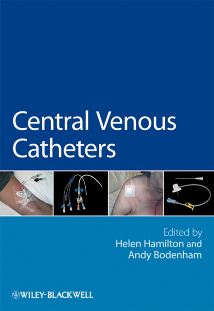 Central Venous Catheters, Paperback / softback Book