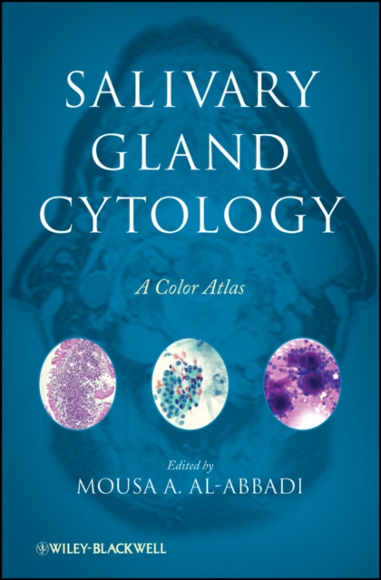 Salivary Gland Cytology : A Color Atlas, Hardback Book