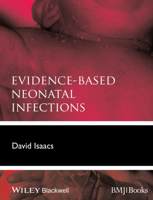 Evidence-Based Neonatal Infections, Paperback / softback Book