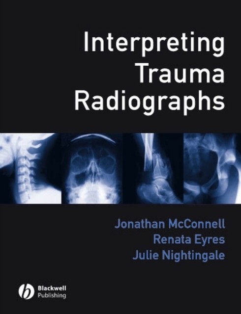 Interpreting Trauma Radiographs, PDF eBook