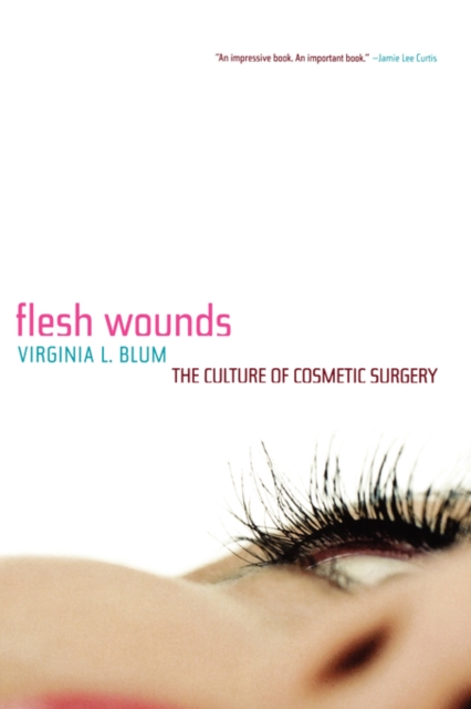 Flesh Wounds : The Culture of Cosmetic Surgery, Paperback / softback Book