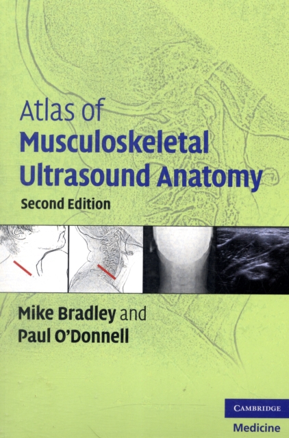 Atlas of Musculoskeletal Ultrasound Anatomy, Paperback / softback Book