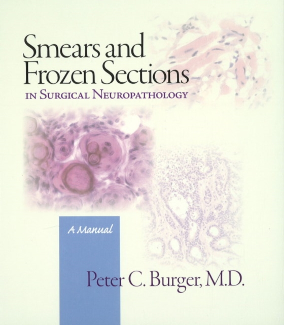 Smears and Frozen Sections in Surgical Neuropathology : A Manual, Hardback Book