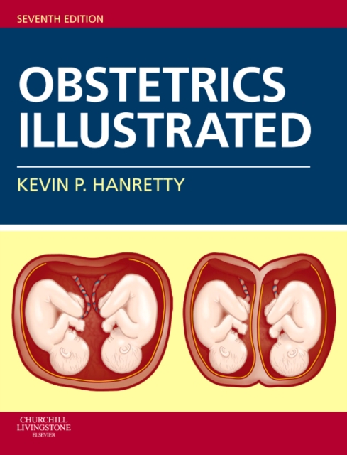 Obstetrics Illustrated, Paperback / softback Book