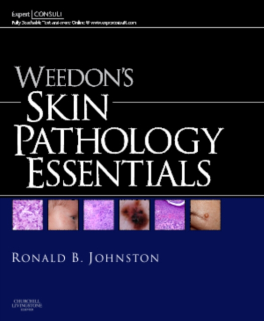Weedon's Skin Pathology Essentials : Expert Consult: Online and Print, Mixed media product Book