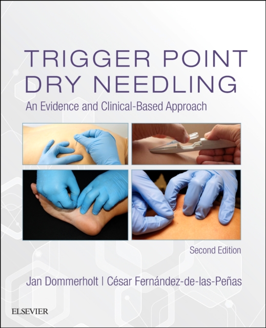 Trigger Point Dry Needling : An Evidence and Clinical-Based Approach, Hardback Book