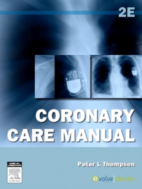 Coronary Care Manual, EPUB eBook