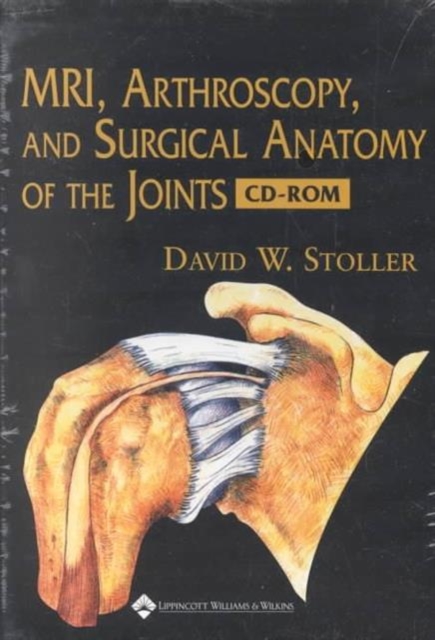 MRI, Arthroscopy,and Surgical Anatomy of the Joints : PC/Mackintosh, CD-Audio Book