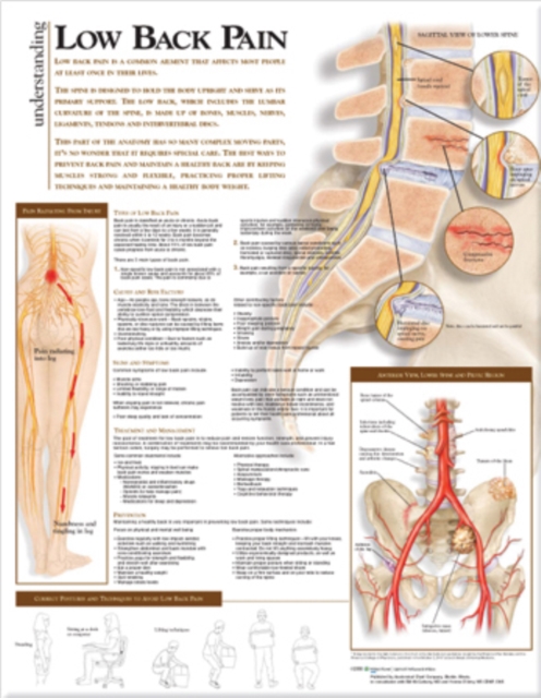 Understanding Low Back Pain Anatomical Chart, Wallchart Book