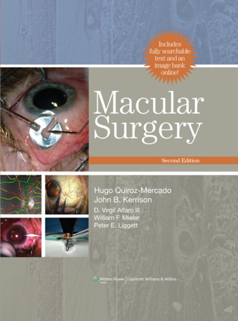 Macular Surgery, Hardback Book