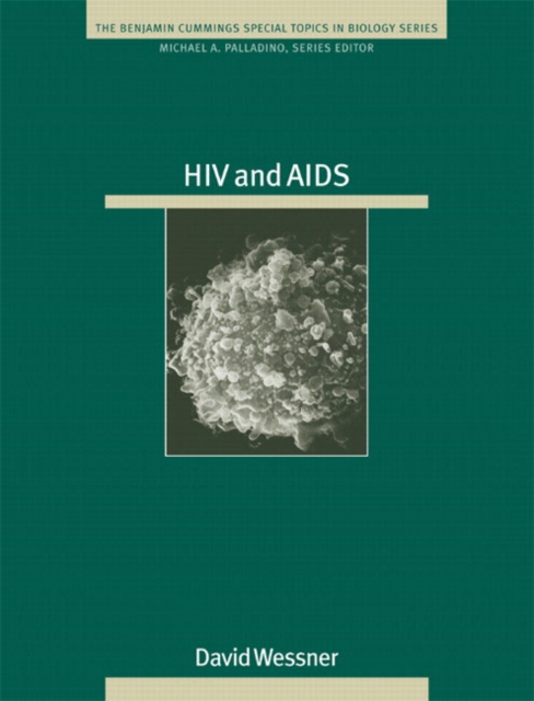 HIV and AIDS, Paperback Book