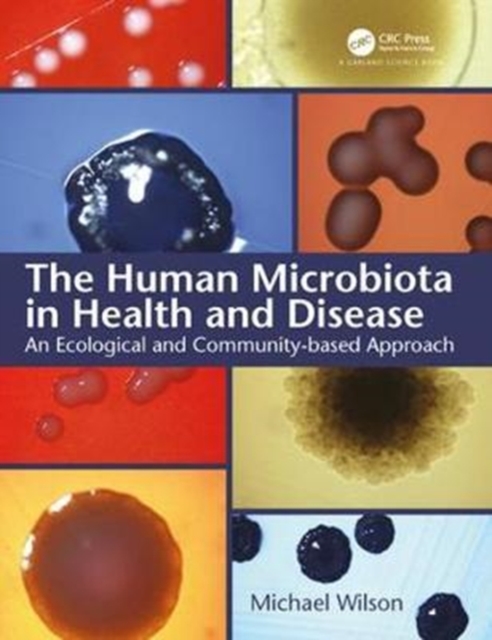 The Human Microbiota in Health and Disease : An Ecological and Community-based Approach, Paperback / softback Book
