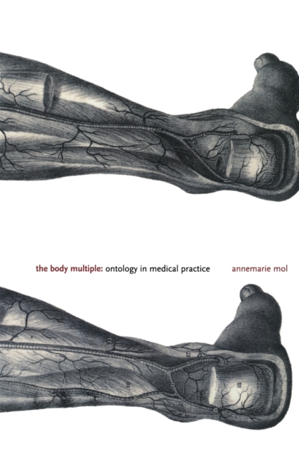 The Body Multiple : Ontology in Medical Practice, Paperback / softback Book