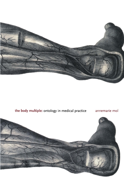 The Body Multiple : Ontology in Medical Practice, PDF eBook