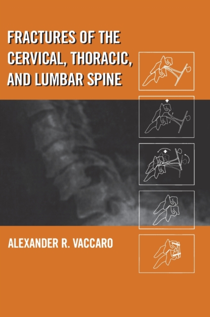 Fractures of the Cervical, Thoracic, and Lumbar Spine, Hardback Book