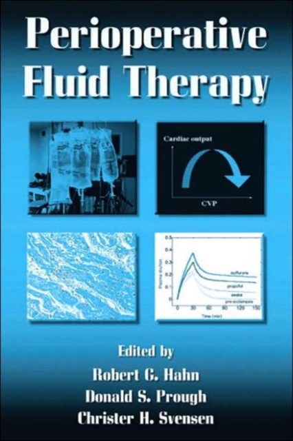 Perioperative Fluid Therapy, Hardback Book