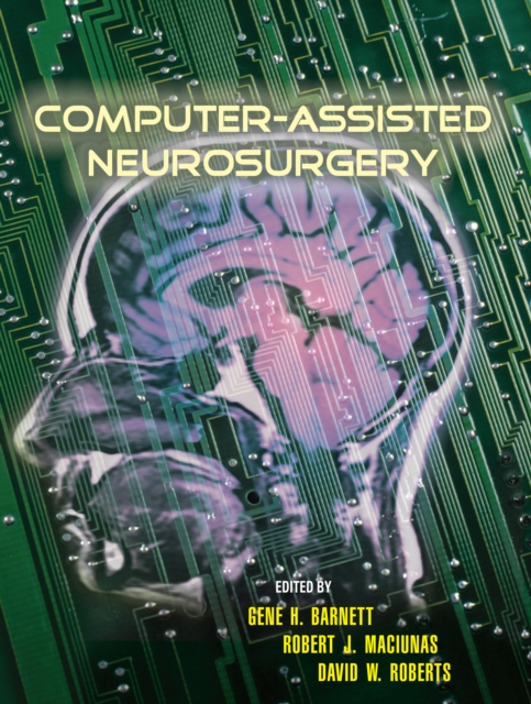 Computer-Assisted Neurosurgery, PDF eBook