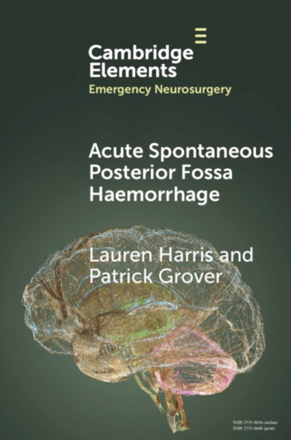 Acute Spontaneous Posterior Fossa Haemorrhage, Paperback / softback Book