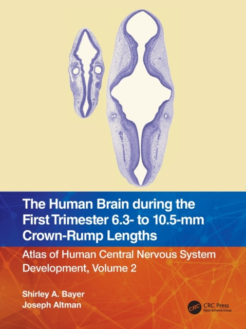 The Human Brain during the First Trimester 6.3- to 10.5-mm Crown-Rump Lengths : Atlas of Human Central Nervous System Development, Volume 2, Paperback / softback Book
