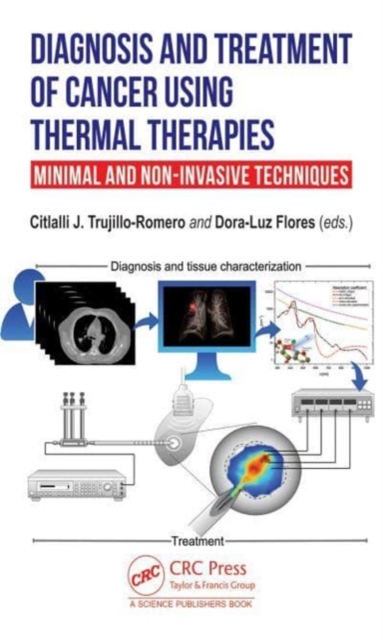 Diagnosis and Treatment of Cancer using Thermal Therapies : Minimal and Non-invasive Techniques, Hardback Book