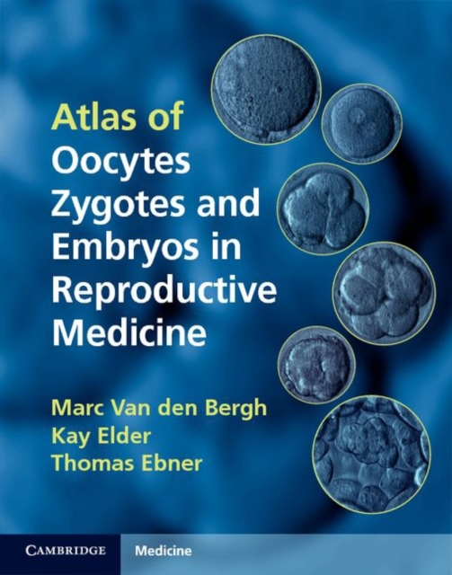 Atlas of Oocytes, Zygotes and Embryos in Reproductive Medicine Hardback with CD-ROM, Mixed media product Book