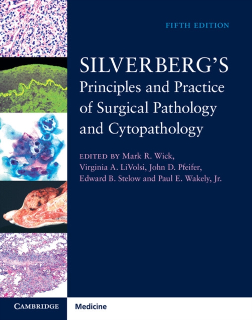 Silverberg's Principles and Practice of Surgical Pathology and Cytopathology 4 Volume Set with Online Access, Multiple-component retail product Book