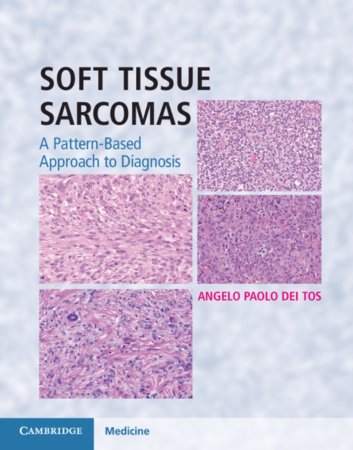Soft Tissue Sarcomas Hardback with Online Resource : A Pattern-Based Approach to Diagnosis, Mixed media product Book