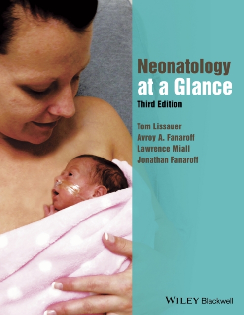 Neonatology at a Glance, Paperback / softback Book