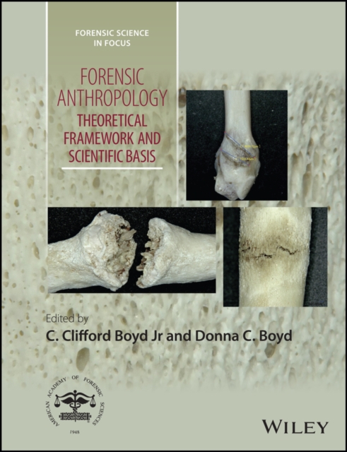 Forensic Anthropology : Theoretical Framework and Scientific Basis, Hardback Book