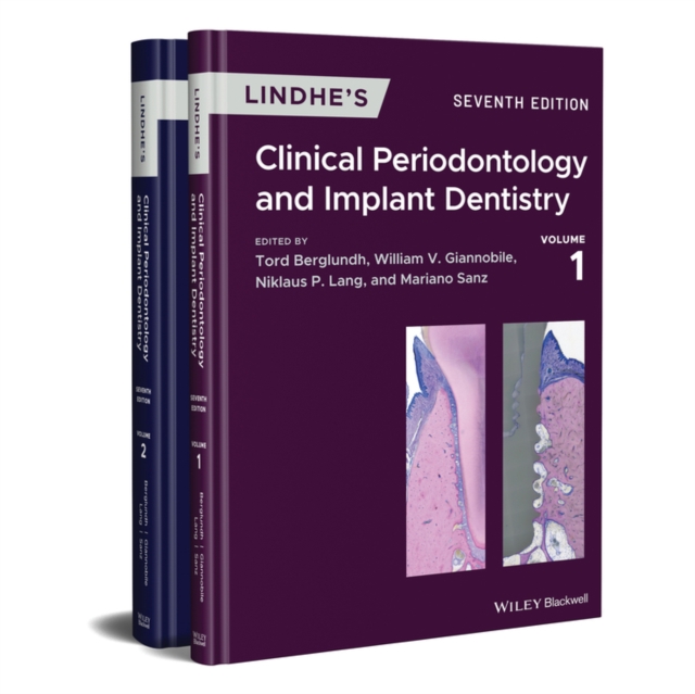Lindhe's Clinical Periodontology and Implant Dentistry, 2 Volume Set, Hardback Book