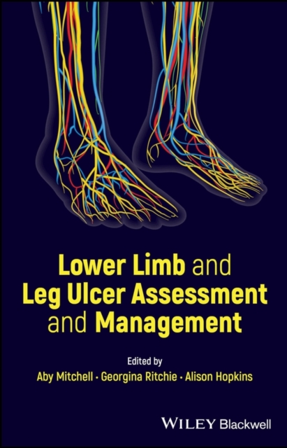 Lower Limb and Leg Ulcer Assessment and Management, EPUB eBook