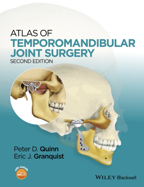 Atlas of Temporomandibular Joint Surgery, Hardback Book