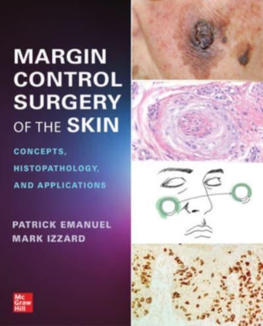 Margin Control Surgery of the Skin: Concepts, Histopathology, and Applications, Paperback / softback Book